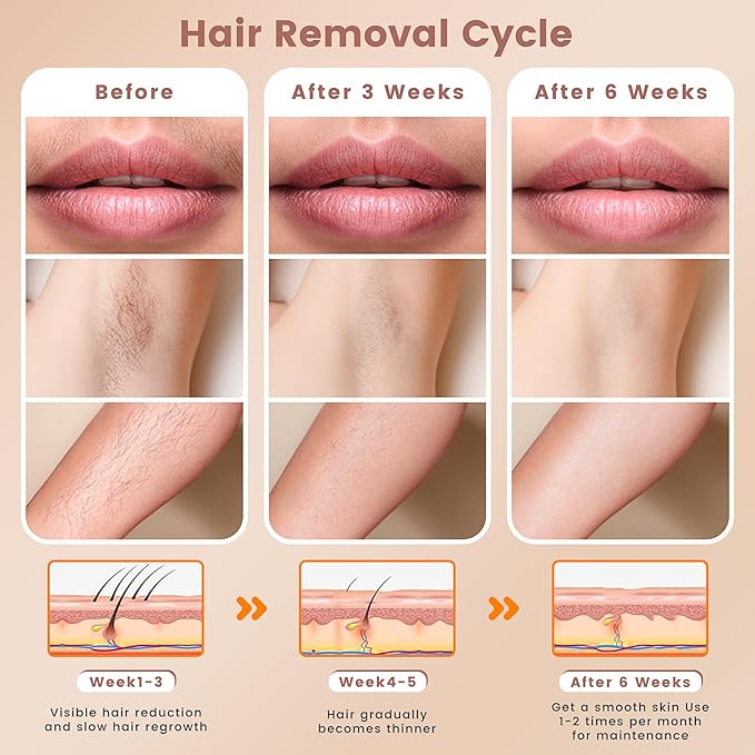 IPL Hair Removal Device, Hair Removal for Women and Men at home for Armpits Legs Arms Bikini Line,model S3