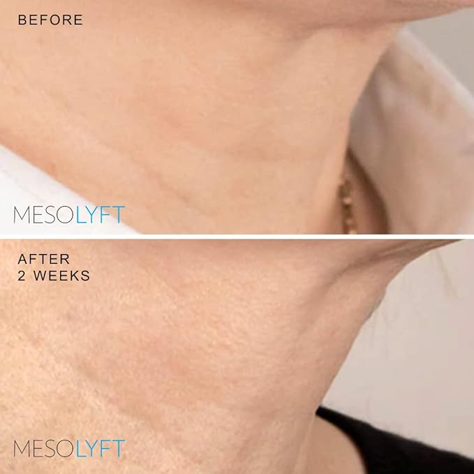 Neck & Lip Plumper Combo with Roller to Instantly Plump Lips & Neck - Neck Serum Improves the Neck Skin - Plumping Serum to Moisturize Your Lips and Neck