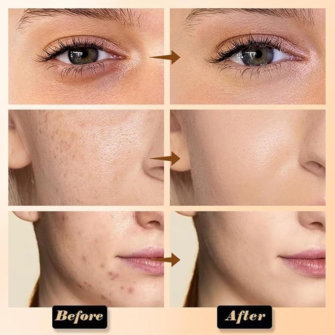 evpct 6 Colors Concealers Full Coverage Cream Contour Palette with Brush for Older Women, Under Eye Color Corrector Tri Color Pot Concealer Palette for Dark Circles Mature Skin Makeup, Waterproof, B1