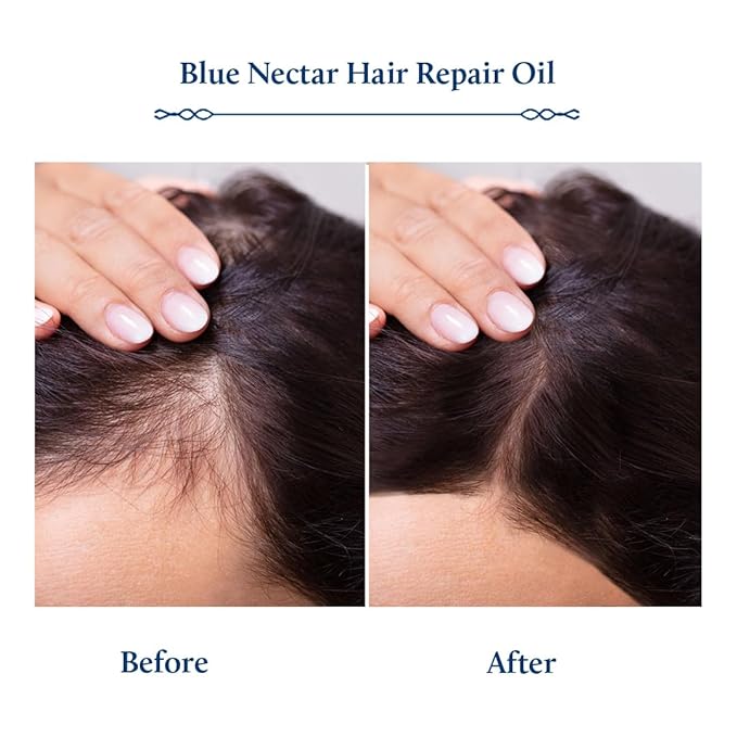 Blue Nectar Rosemary and Bhringraj Ayurvedic Scalp Oil for Hair Growth with Amla, 3.38 Fl Oz