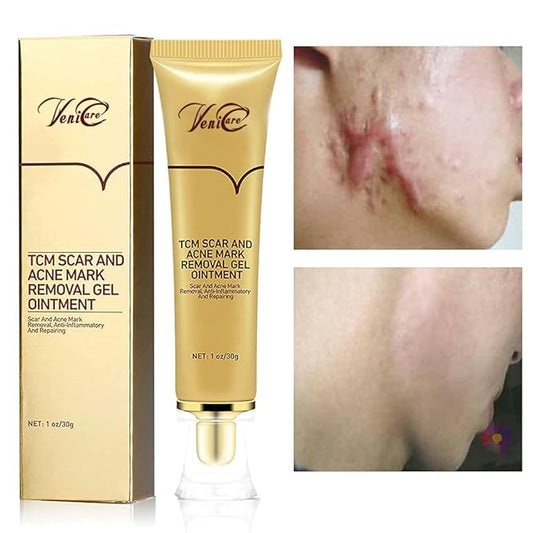 Acne Scar Removal Cream Stretch Marks Face Skin Cream Shrink Pores Gel-Fade Scar Marks Acne Skin Care (Packaging Upgrade) VeniCare