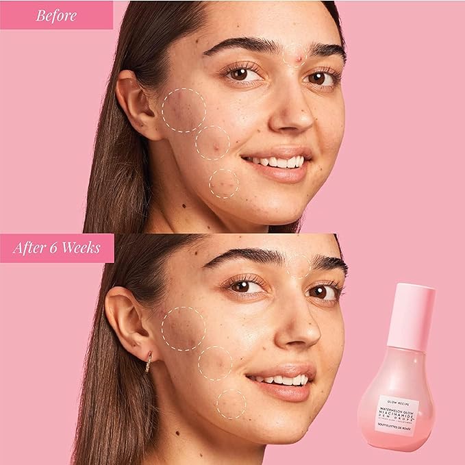 Glow Recipe Stocking Stuffer Niacinamide Serum Dew Drops Ornament - Hydrating Face Serum & Illuminating Makeup Primer for Dewy, Glass Skin + Hyaluronic Acid for Plumping & Highlighting (15 ml)