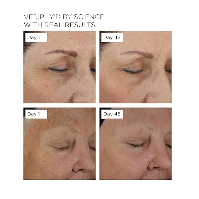 20/20 Eye Cream for Dark Circles and Puffiness | Vegan | Clean | Natural | Cruelty-free | Anti-Aging | Eye Cream for Wrinkles | Women in STEM