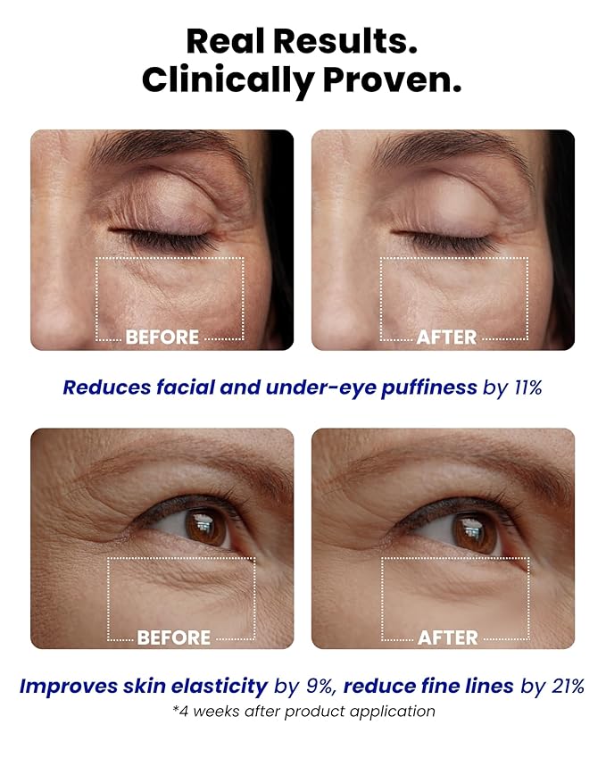 Ice Roll Serum | Cooling & Hydrating Roll-On Serum for Face, Puffy Eyes, Bakuchiol & Collagen for Firming & Lifting, Facial Roller for Depuffing, Under Eye Bag Treatment | Korean Skin Care