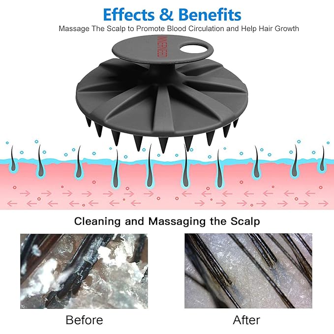 INNERNEED Scalp Massager Shampoo Brush, Wet & Dry Manual Scalp Care Head Scrubber Hair Washing, Soft Silicone Bristles, for Hair Growth, Dandruff Removal (Black+Pink)