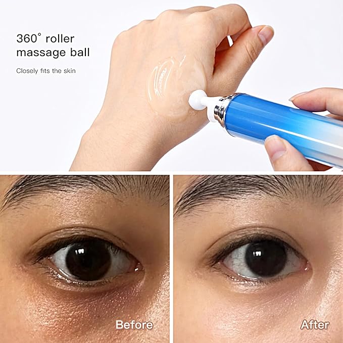 5% Caffeine Eye Serum with 360° Massage Rollerball Topper,Caffeine Eye Cream for Dark Circles,Wrinkles,Puffiness and Fine Lines,Under Eye Roller Cream Eye Bags Treatment for Women and Men