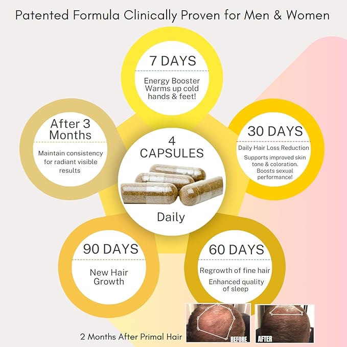3 PK- 100% Natural Growth Treatment, Reduces Hair Loss, US Patented Formula Proven Effective for Men & Women, 100% Vegan, Non-GMO, 90-Day Supply, 3 Pack