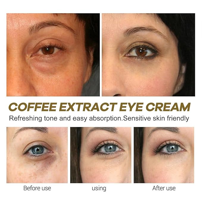 2PCS Caffeine Eye Cream for Dark Circles and Puffiness, Anti-Wrinkle Stay-Up Late Retinol Eye Cream, Tightening & Firming Skin, Dilute Dark Circles