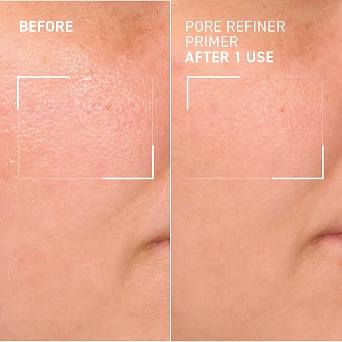 Dr. Brandt Pores No More, Pore Refiner Primer - Instantly Minimizes the Appearance of Pores, Absorbs Oil & Mattifies Shine - 0.5 fl oz