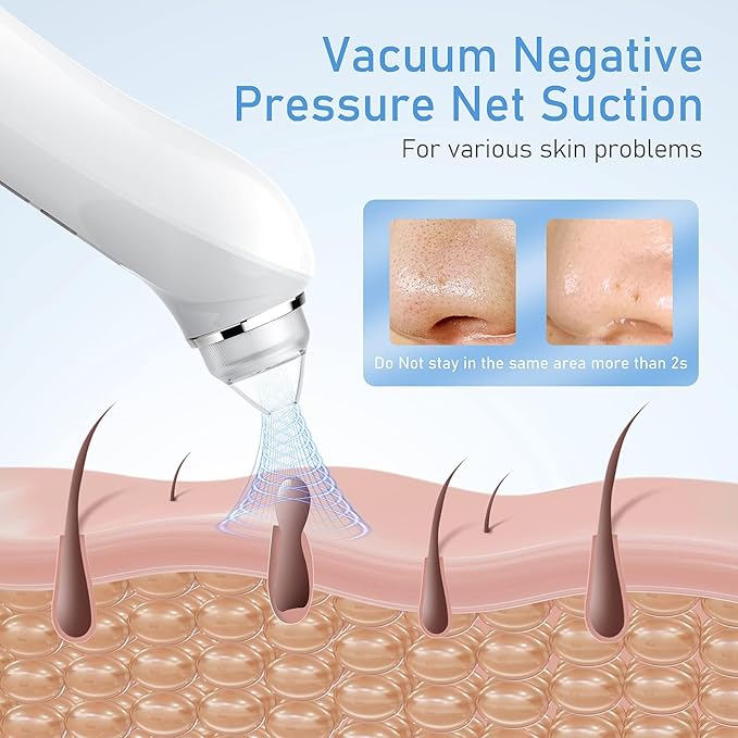 Facial Pore Blackhead Remover Vacuum, 1080P Camera Blackhead Remover, 20x Zoom, 8 LEDs ＆ 3 Suction Modes, 800mAh Battery & USB - 6 Heads Pore Cleaner Kit for Women&Men(Orange)