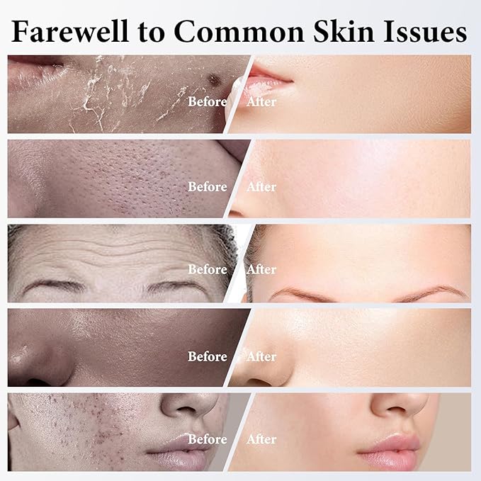 ISTON 4 Pack Collagen Face Mask, Collagen Real Deep Anti Wrinkle Lifting Mask | Firming,Pore Minimizing | Overnight Hydrating Face Masks Skincare for Glass Skin |TikTok Trend Items Skin Care