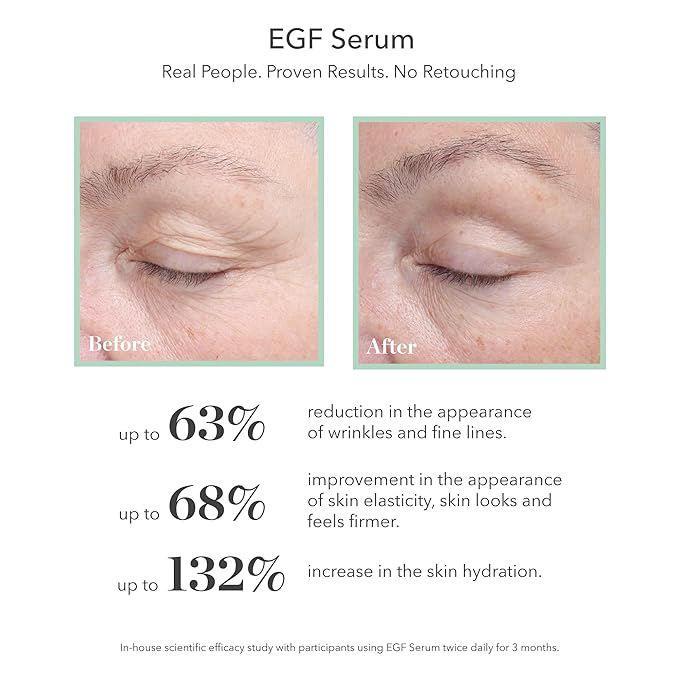 BIOEFFECT Classic Duo of EGF Serum and EGF Eye Serum plus Refill, Skincare Gift Set for Wrinkle Fighting, Moisturizing, Firming, Anti-Aging Facial Treatments featuring Barley Growth Factor