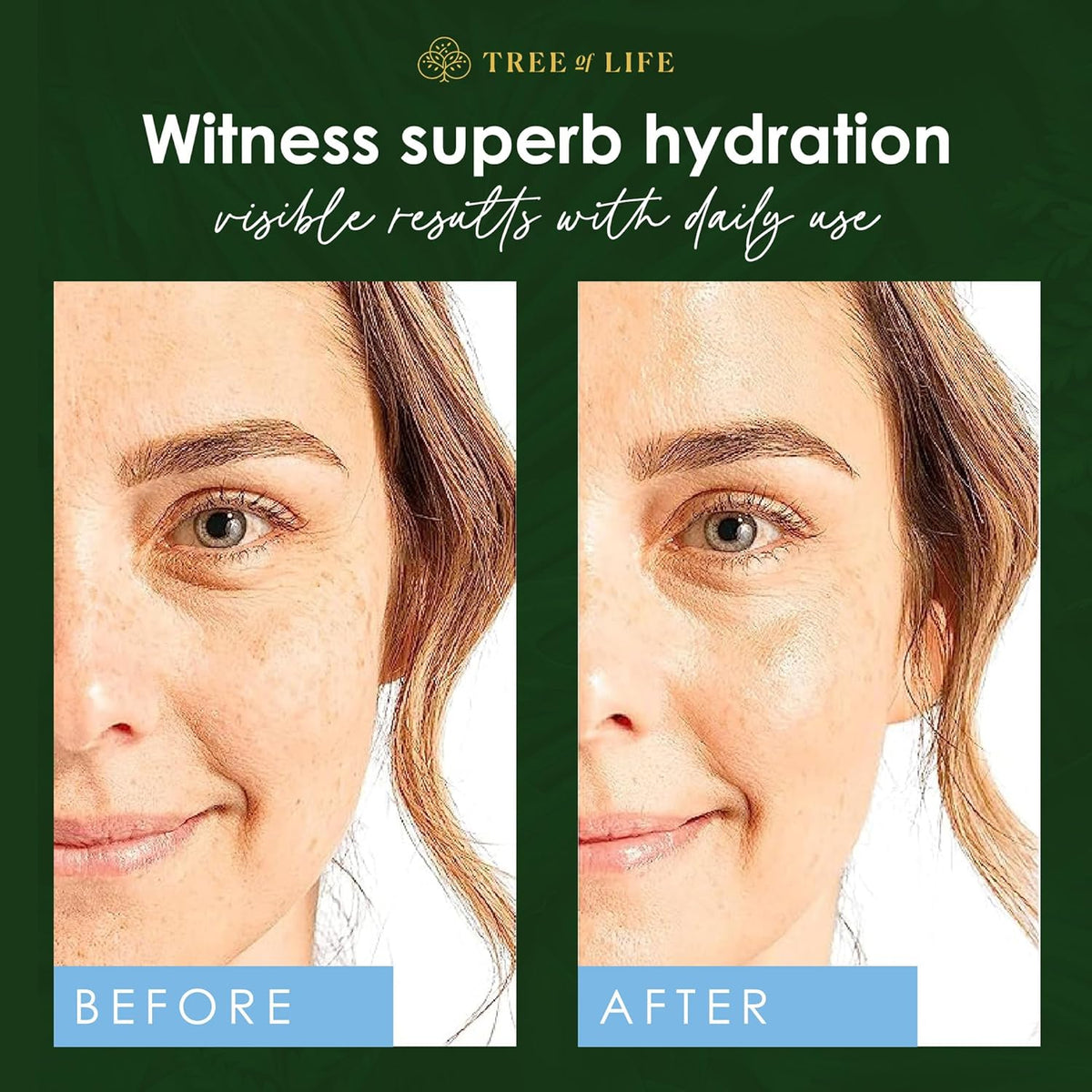 Tree of Life Beauty Hyaluronic Acid Serum, Skin Brightening Face Oil for Dark and Age Spots, Facial Serums for Dry and Sensitive Skin Care with Vitamin E for Soft Smooth Skin, 2 Fl Oz, (Pack of 2)