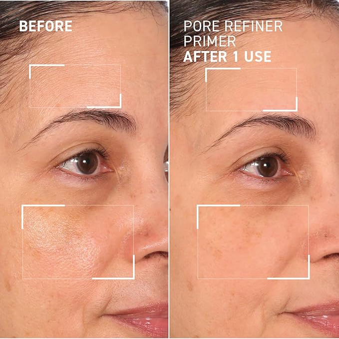 Dr. Brandt Pores No More, Pore Refiner Primer - Instantly Minimizes the Appearance of Pores, Absorbs Oil & Mattifies Shine - 0.5 fl oz