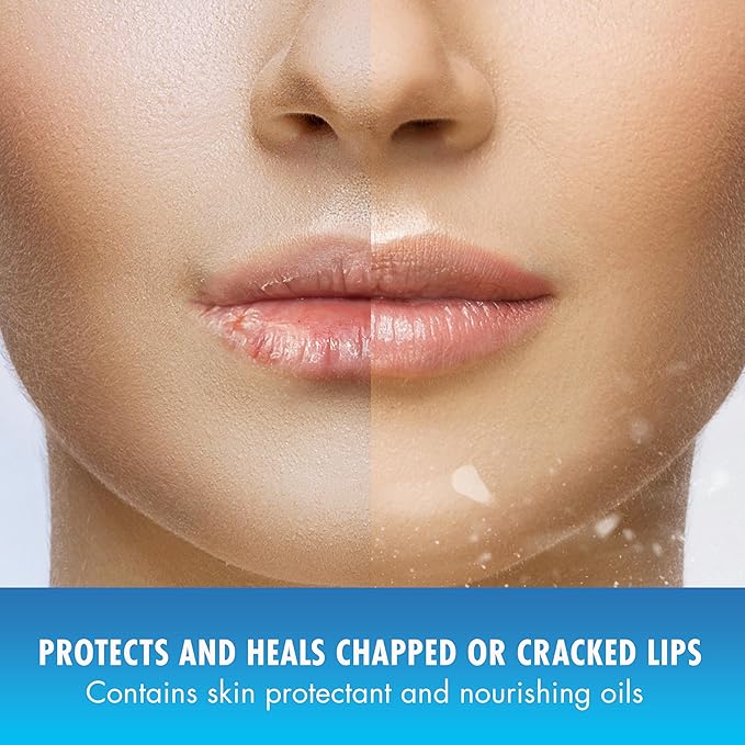 Natural Ice Original SPF 15 Medicated Lip Balm - 12 Count Pack