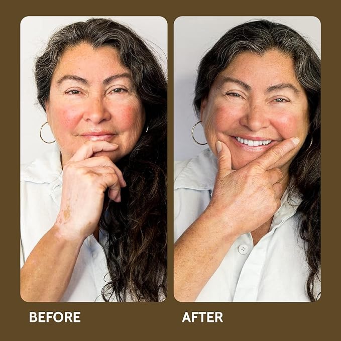 Vitiligo Vanquish Cosmetic Camouflage Kit by Fake Bake Liquid Concealer, Long Lasting Natural Color Customization Eliminates Appearance of Skin Depigmentation For Women & Men - Cover Lasts For Days