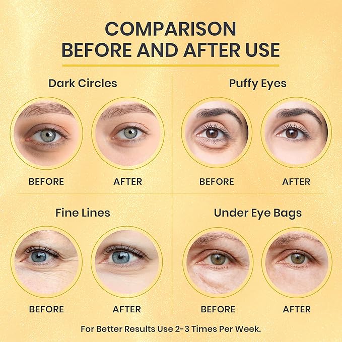 24k Gold Under Eye Patches for Puffy Eyes (7 Pairs) – Gold Foil Under Eye Masks for Dark Circle with Betaine, Hyaluronic Acid – Skincare Eye Bags Patches Treatment for Men & Women