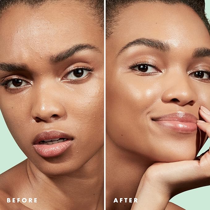 e.l.f. Blemish Control Face Primer, Soothing & Hydrating Makeup Primer For Fighting Blemishes, Grips Makeup To Last, Vegan & Cruelty-free, Large